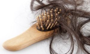 4 Alasan Rambut Rontok Harus Segera Diatasi, Ini Dampak yang Akan Terjadi